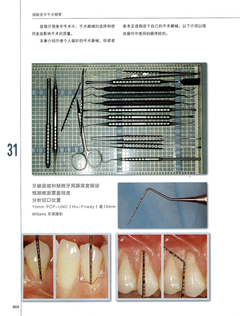 184膜龈美学手术精要_821-831.pdf_第1页