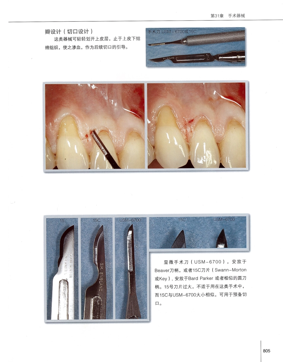 184膜龈美学手术精要_821-831.pdf_第2页