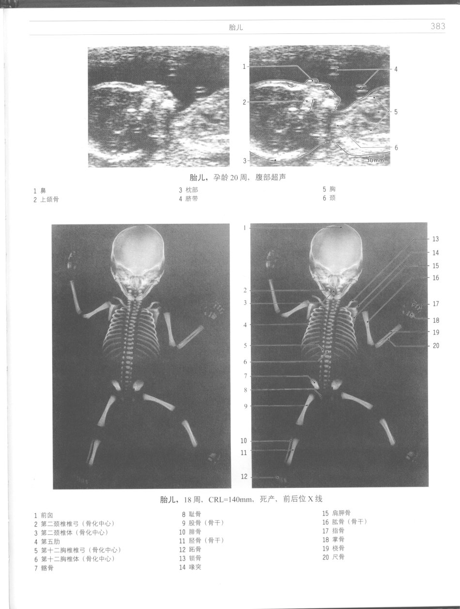 影像解剖学_11724881_385-396.pdf_第1页