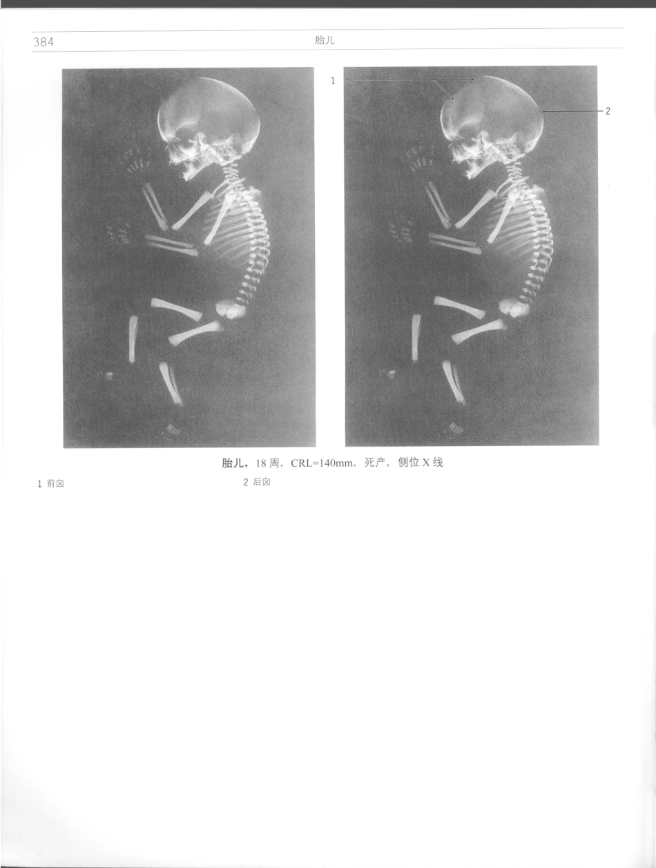 影像解剖学_11724881_385-396.pdf_第2页