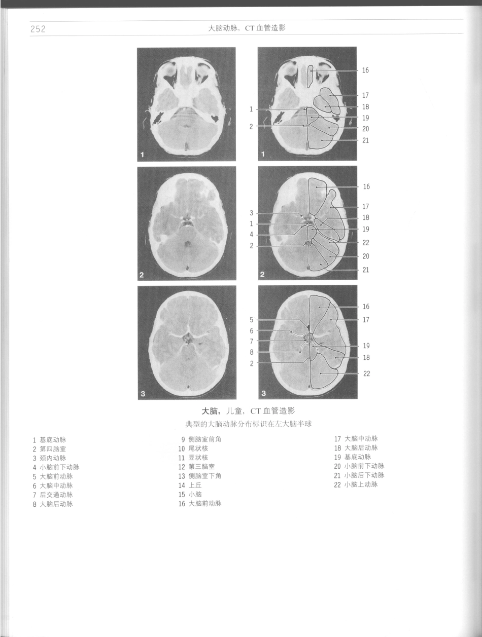 影像解剖学_11724881_253-264.pdf_第2页