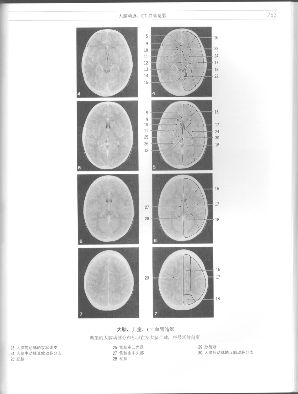 影像解剖学_11724881_253-264.pdf_第3页