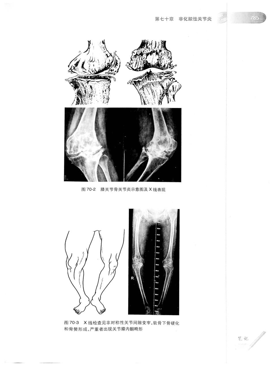02.外科学（第8版）_826-850.pdf_第1页