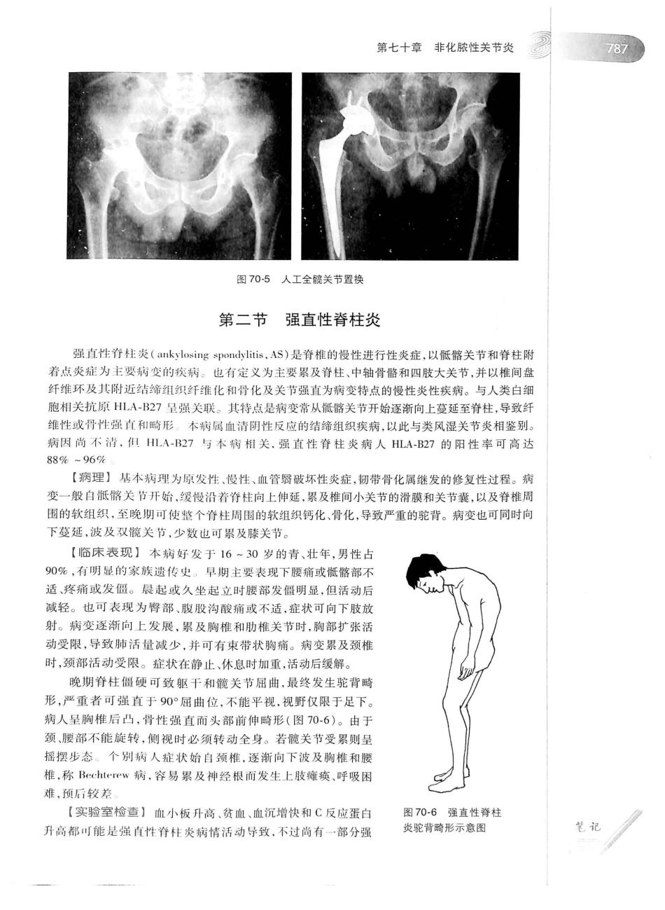 02.外科学（第8版）_826-850.pdf_第3页