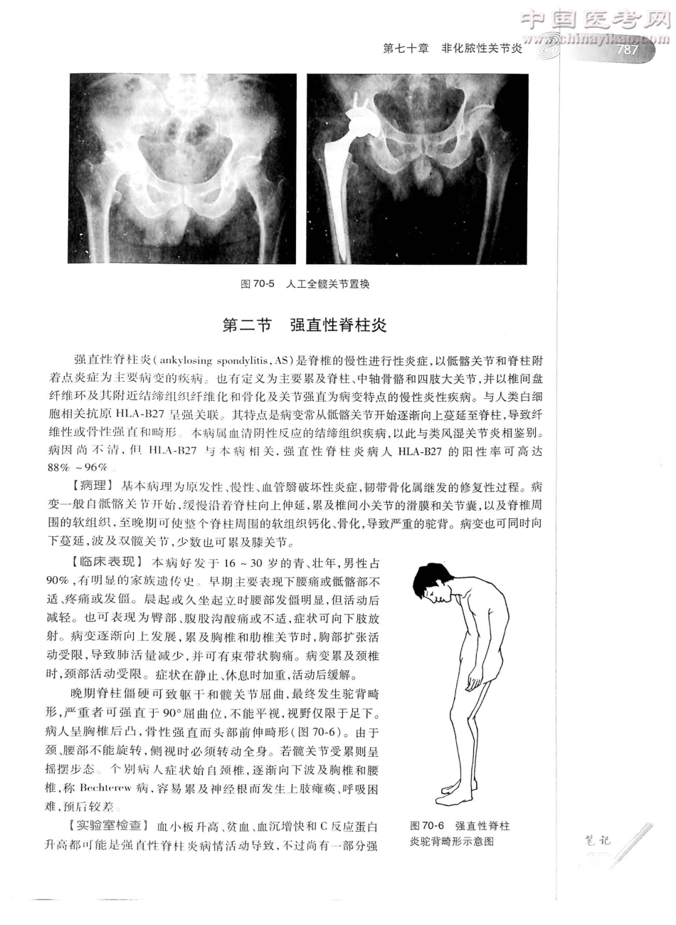 外科学（第8版）完整版-www.bbyxy.]_826-850.pdf_第3页