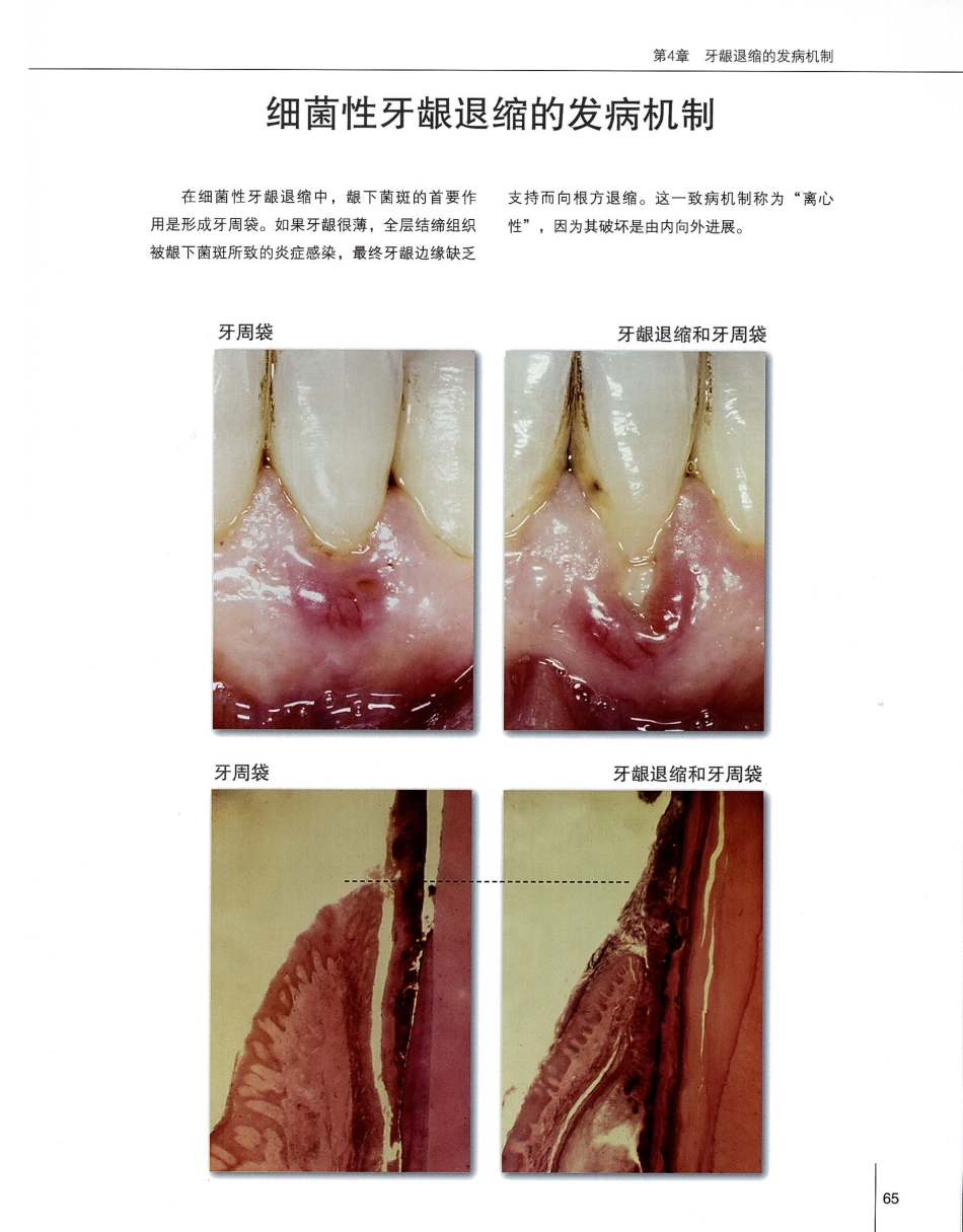 184膜龈美学手术精要_81-100.pdf_第2页