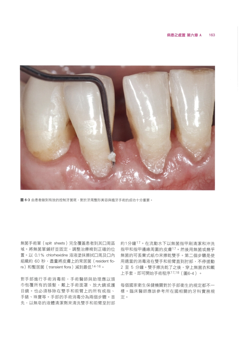 179.牙周整形美容与种植手术_177-184.pdf_第1页