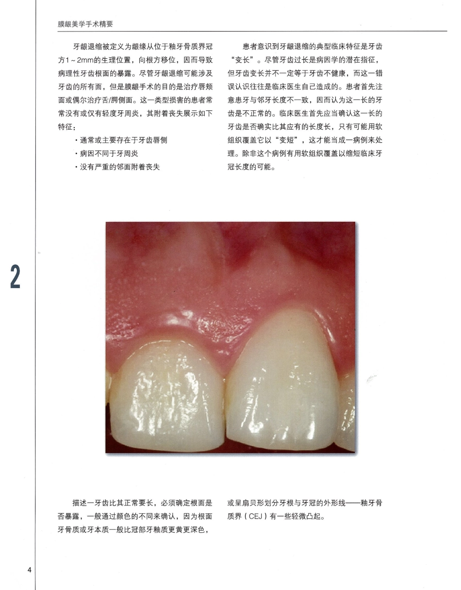 184膜龈美学手术精要_21-40.pdf_第1页