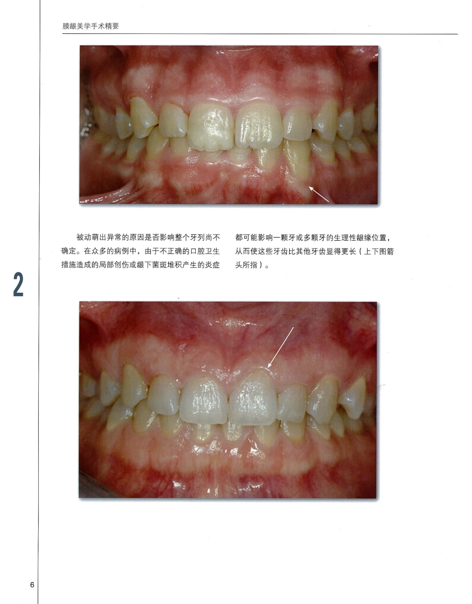 184膜龈美学手术精要_21-40.pdf_第3页