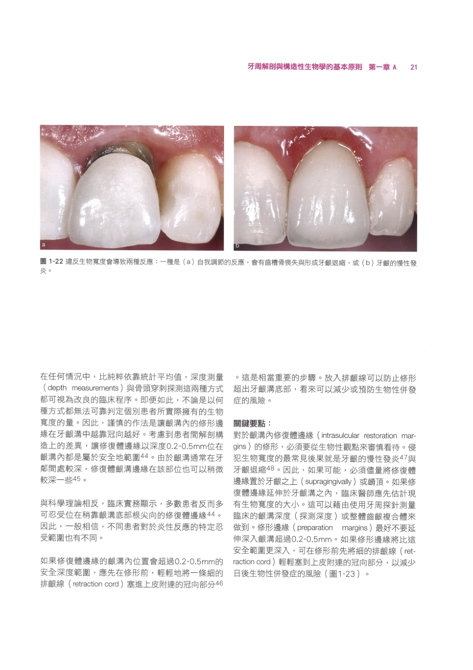 179.牙周整形美容与种植手术_33-40.pdf_第3页