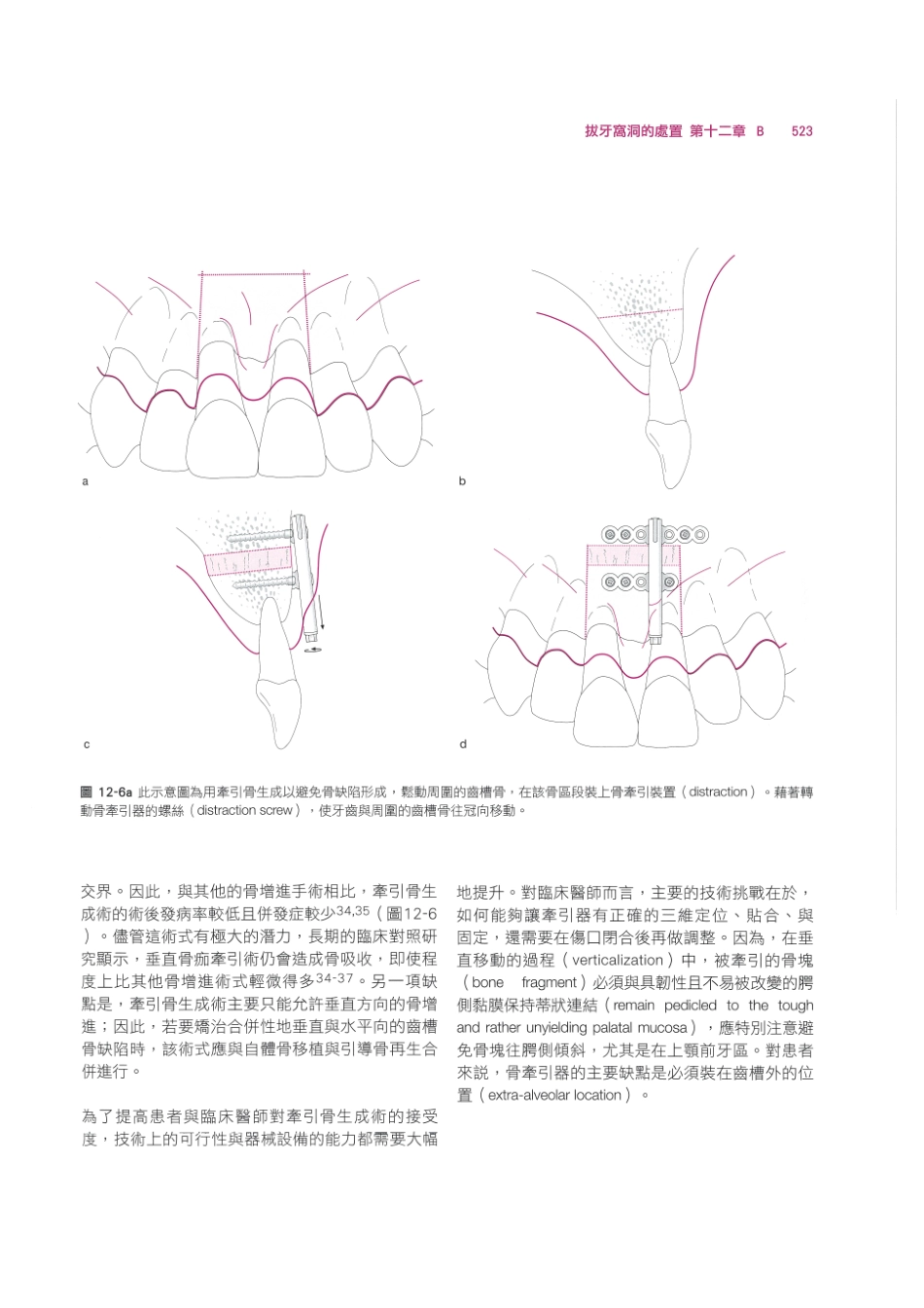 179.牙周整形美容与种植手术_537-544.pdf_第1页