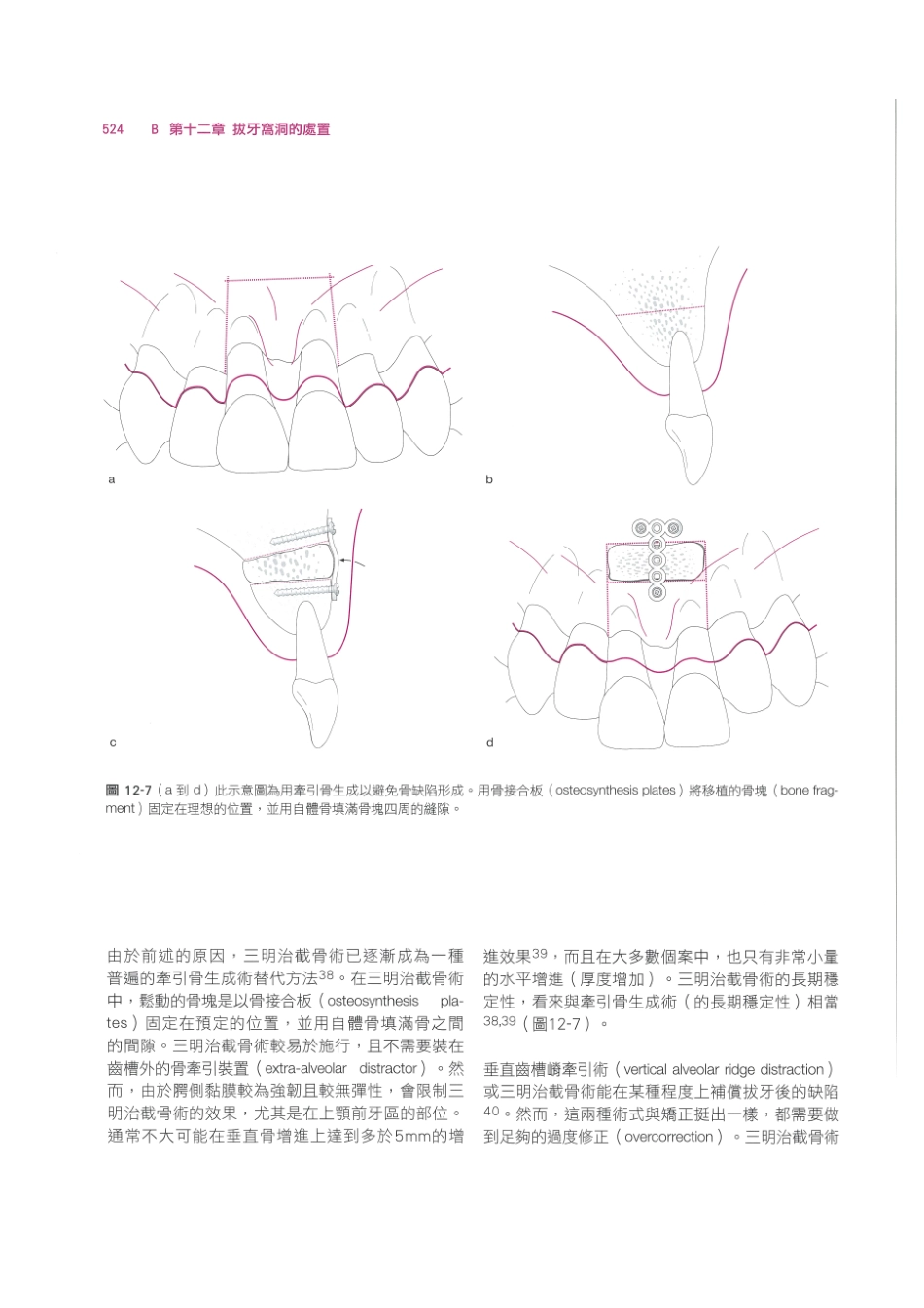179.牙周整形美容与种植手术_537-544.pdf_第2页