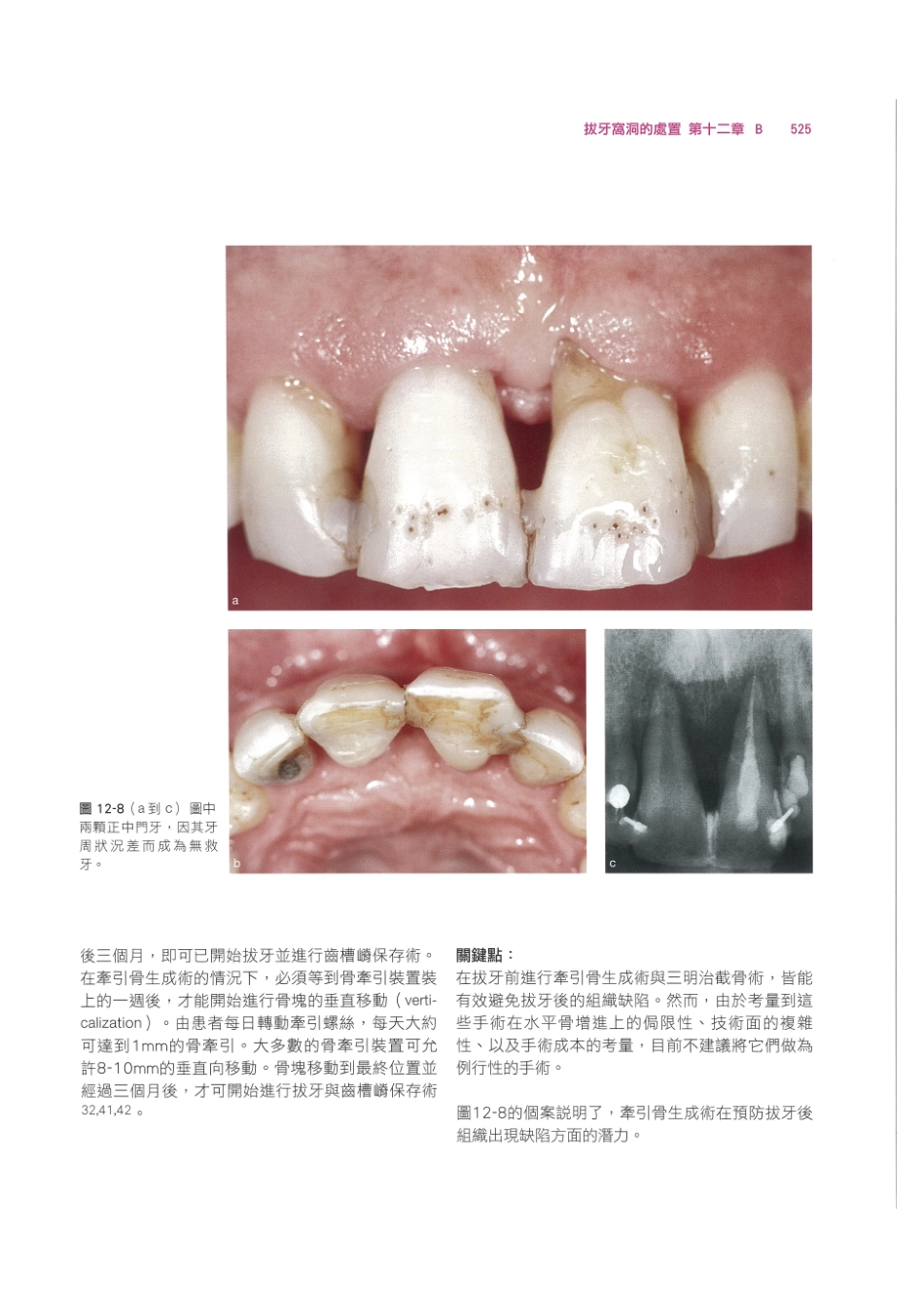 179.牙周整形美容与种植手术_537-544.pdf_第3页