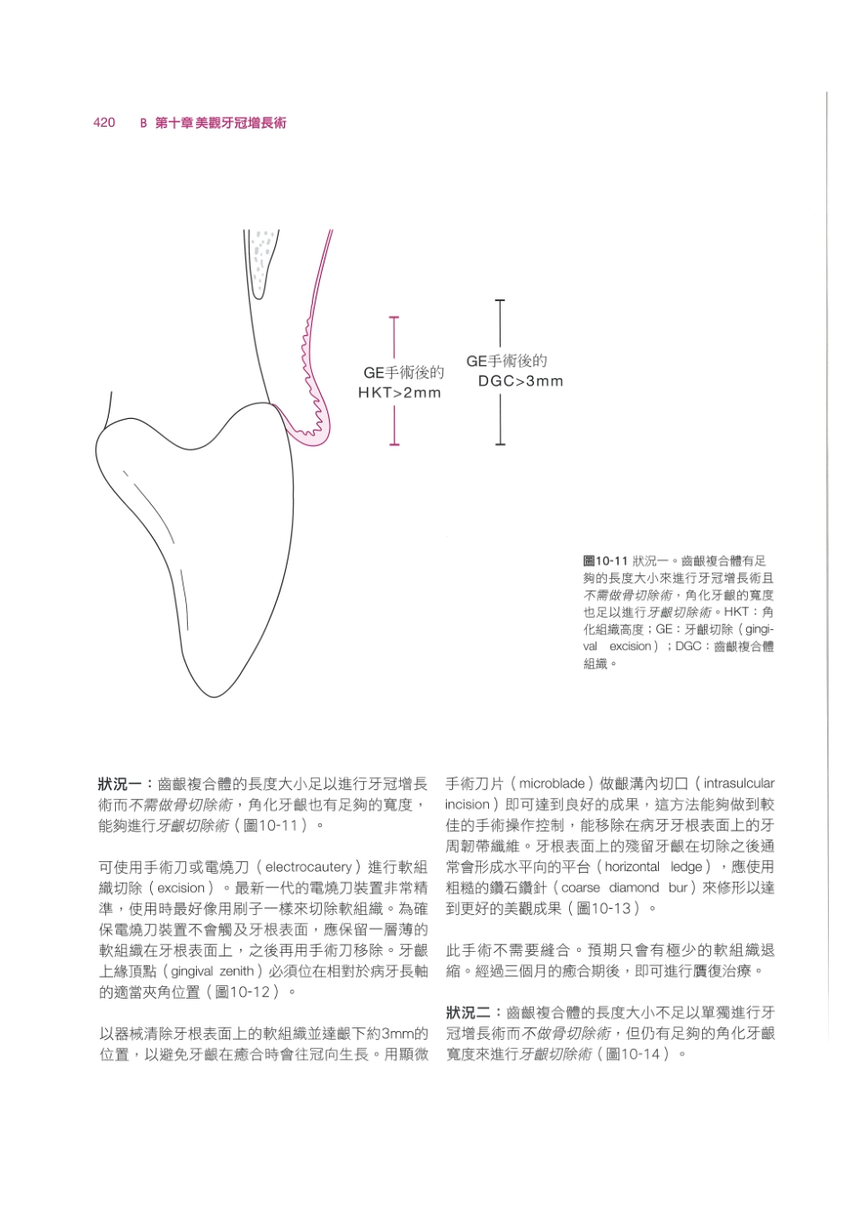 179.牙周整形美容与种植手术_433-440.pdf_第2页