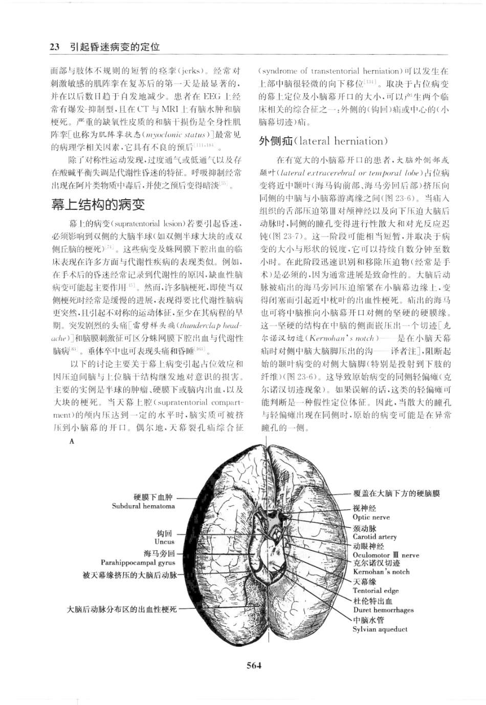 临床神经病学定位++第6版_13196861_571-585.pdf_第3页