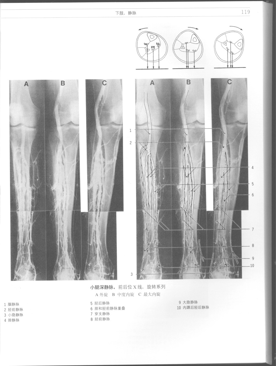 影像解剖学_11724881_121-132.pdf_第1页