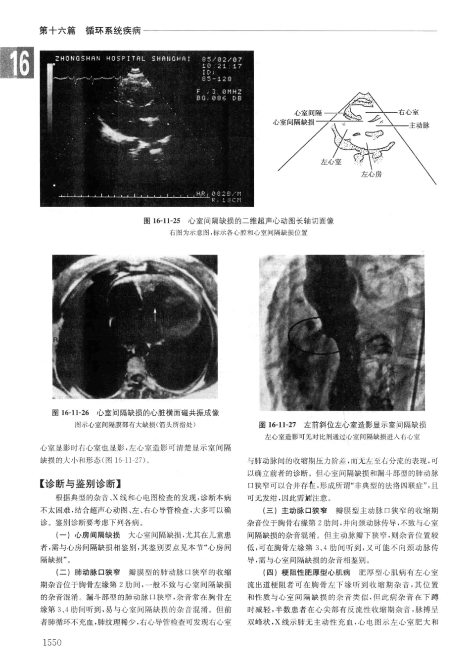实用内科学++第14版++下_13442380_241-270.pdf_第2页