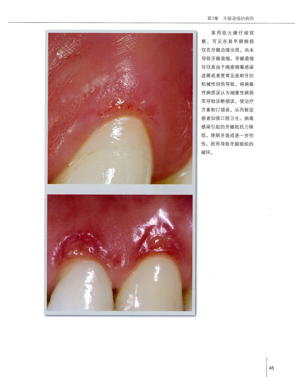 184膜龈美学手术精要_61-80.pdf_第2页