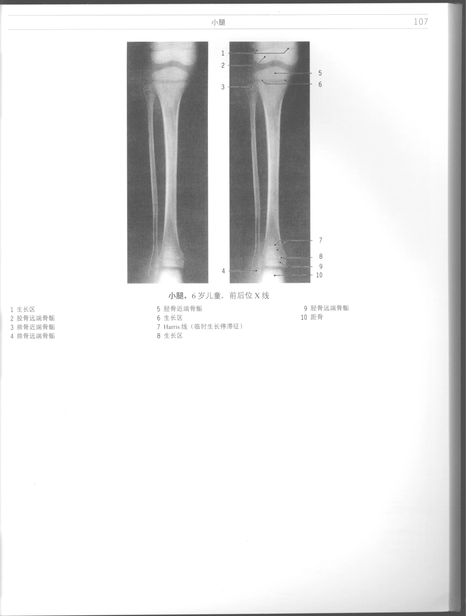 影像解剖学_11724881_109-120.pdf_第1页