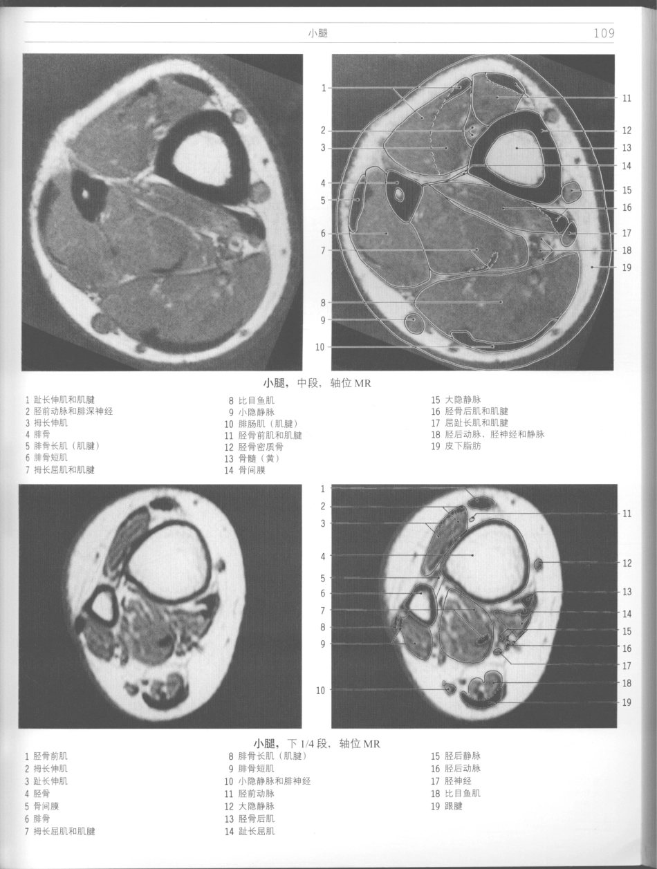 影像解剖学_11724881_109-120.pdf_第3页