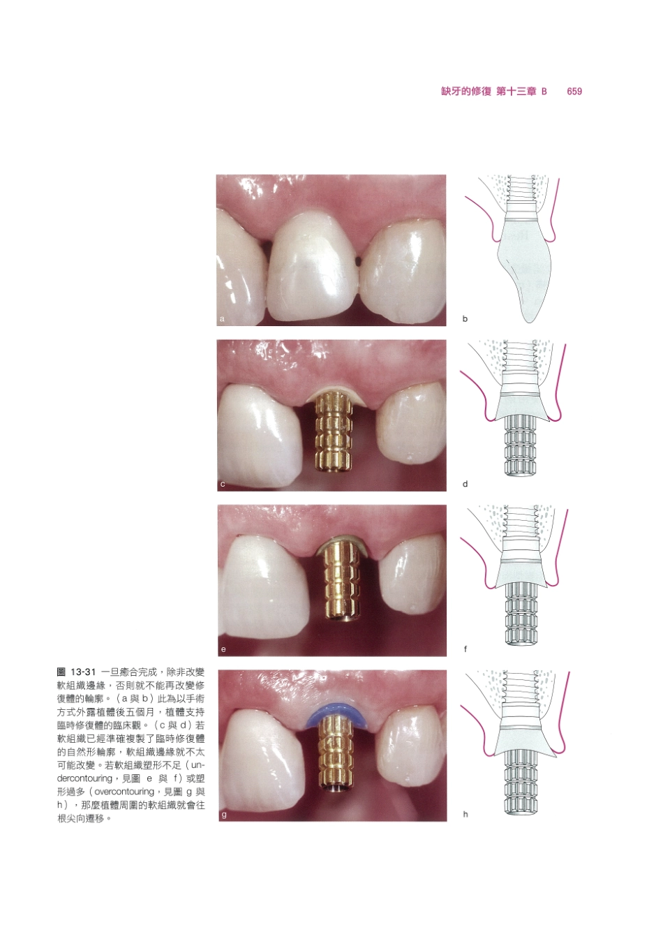 179.牙周整形美容与种植手术_673-680.pdf_第1页