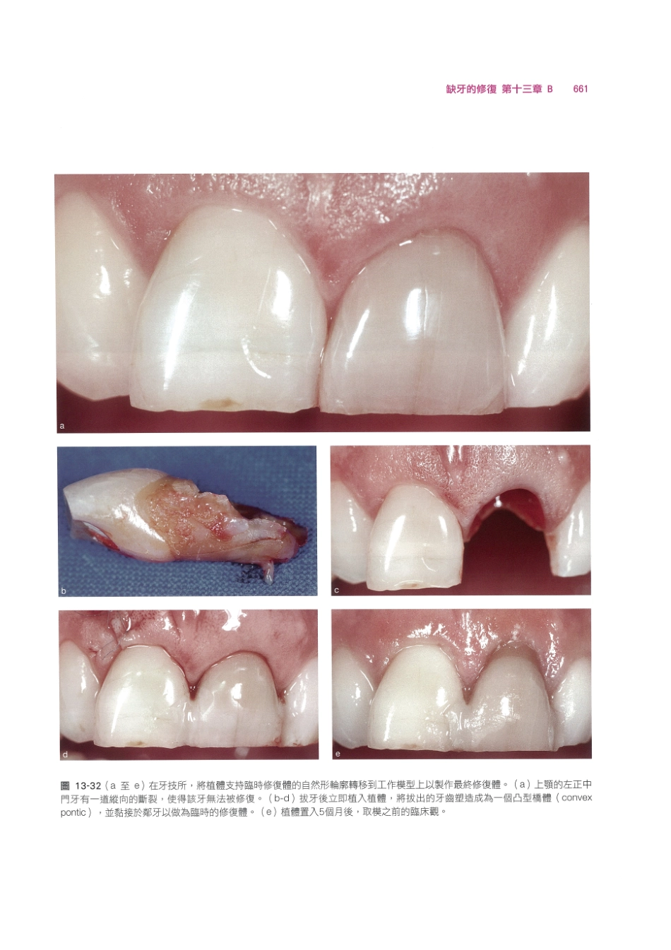 179.牙周整形美容与种植手术_673-680.pdf_第3页