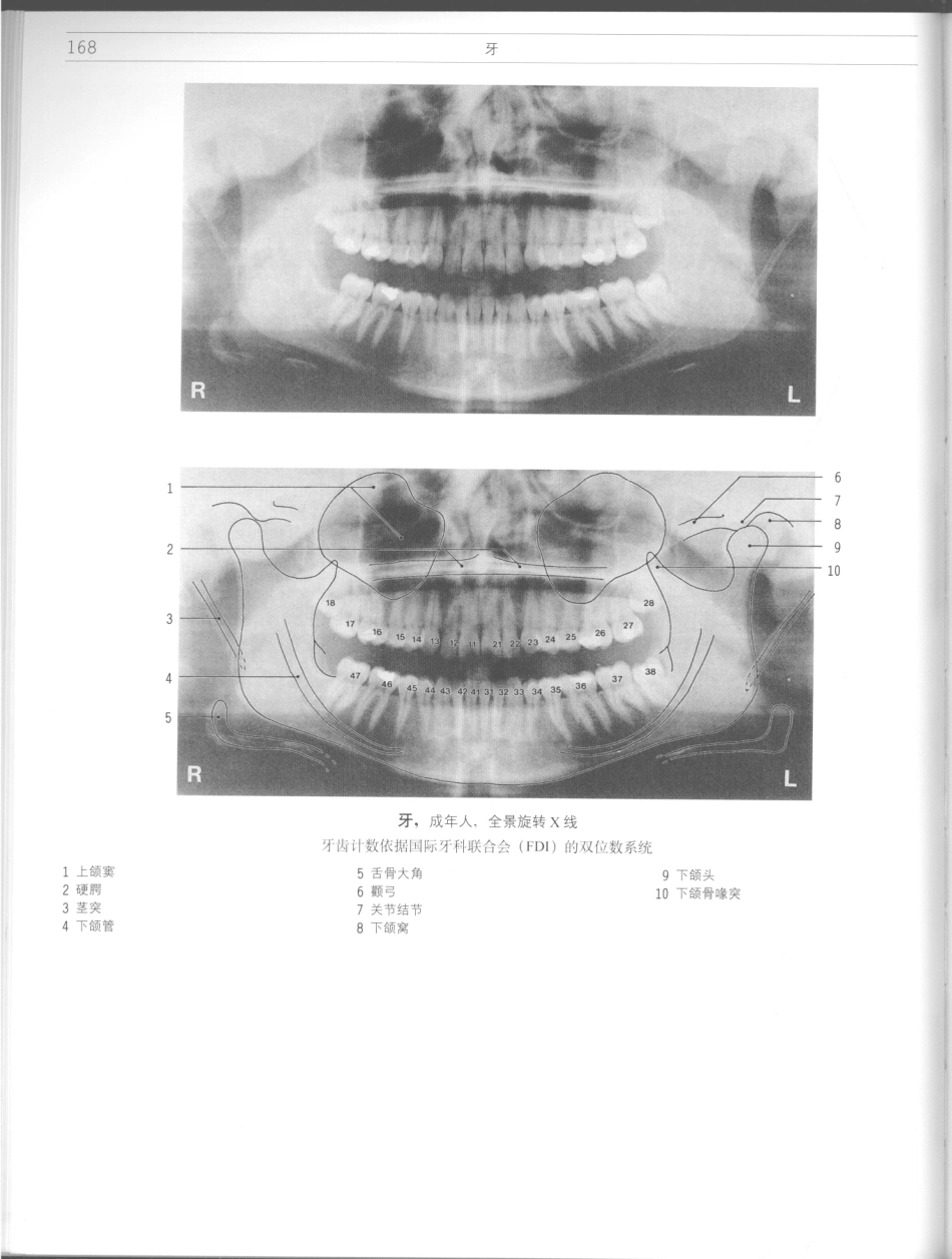 影像解剖学_11724881_169-180.pdf_第2页