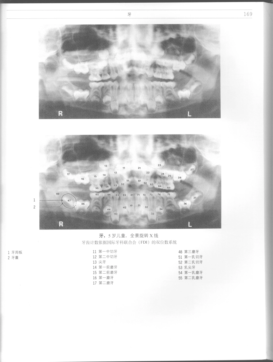 影像解剖学_11724881_169-180.pdf_第3页