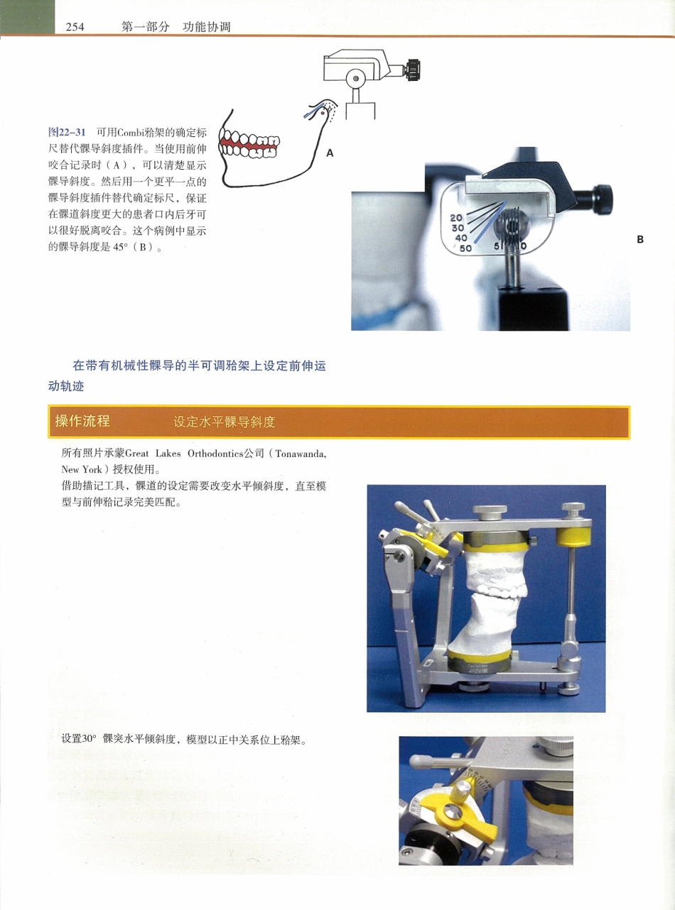 功能牙合学 从颞下颌关节到微笑设计2015年译(彩图)张豪_271-285.pdf_第2页