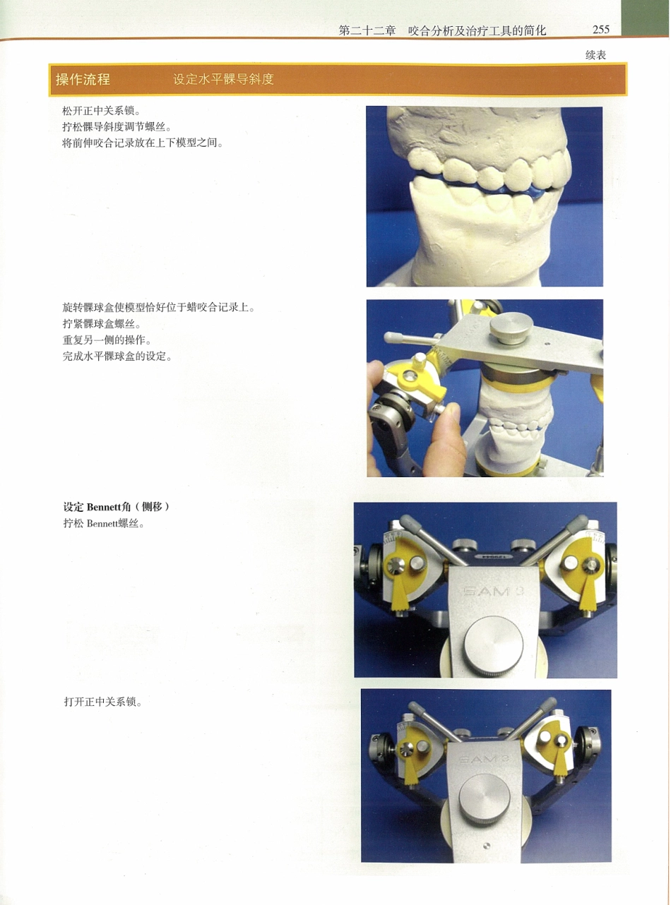 功能牙合学 从颞下颌关节到微笑设计2015年译(彩图)张豪_271-285.pdf_第3页