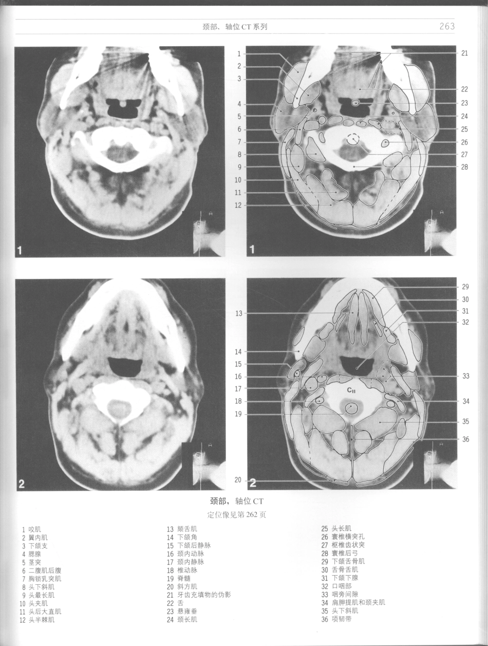 影像解剖学_11724881_265-276.pdf_第1页