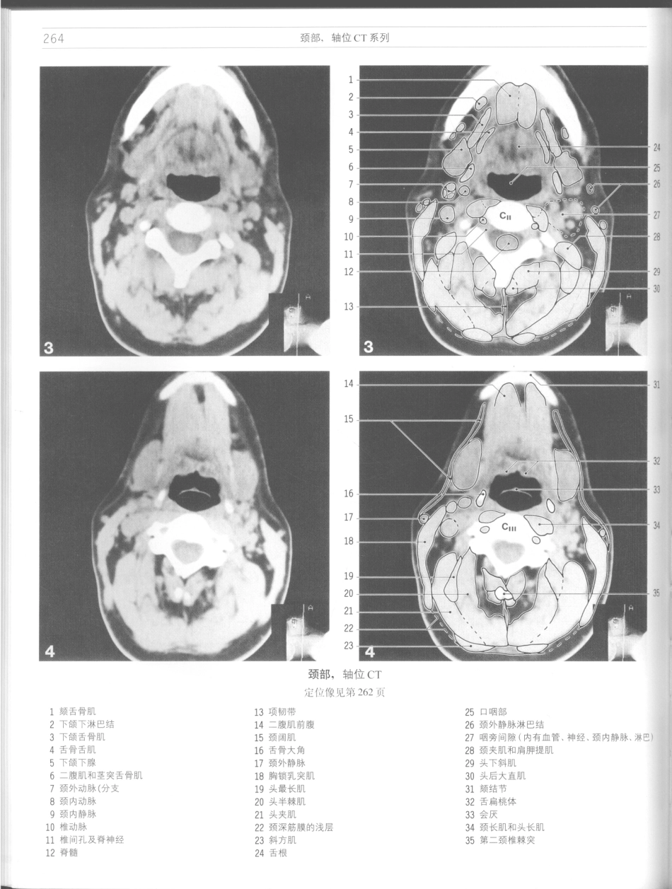 影像解剖学_11724881_265-276.pdf_第2页