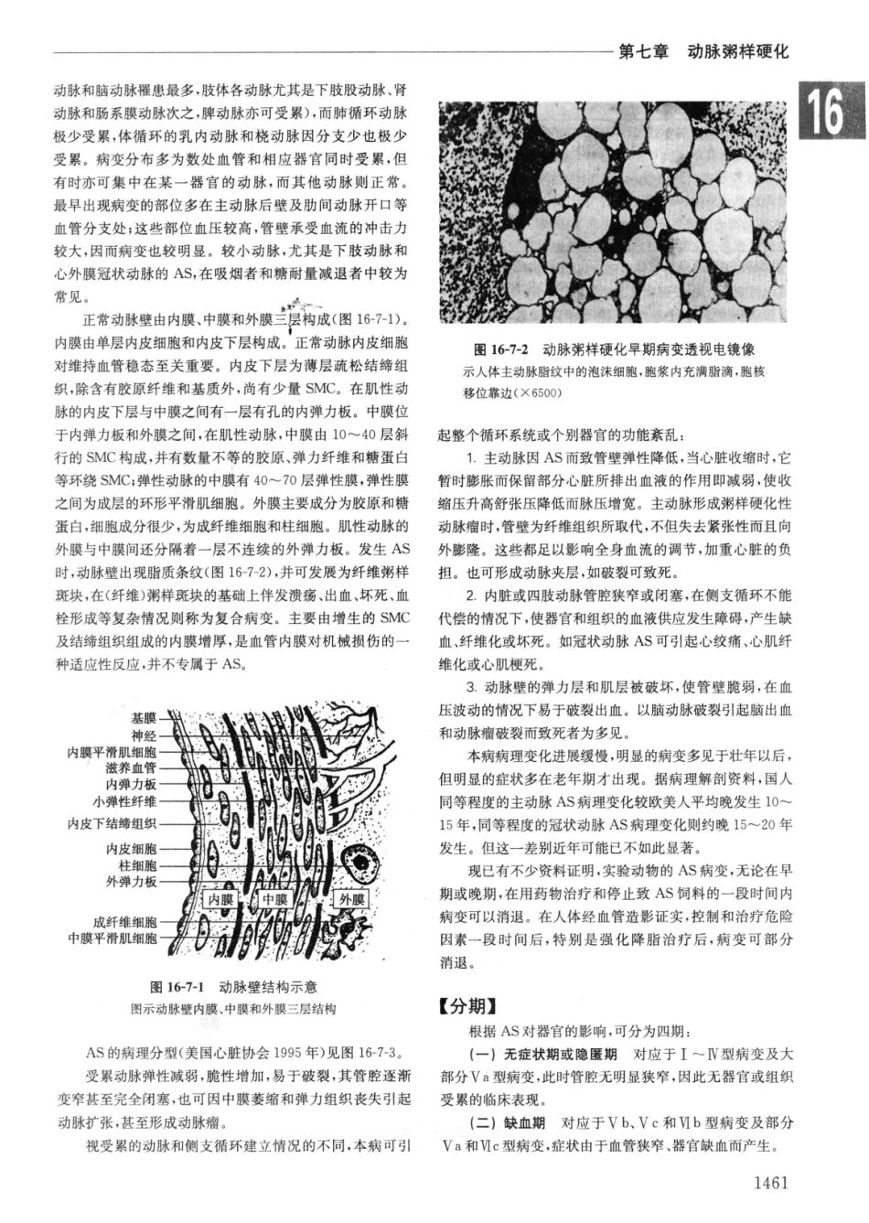 实用内科学++第14版++下_13442380_151-180.pdf_第3页