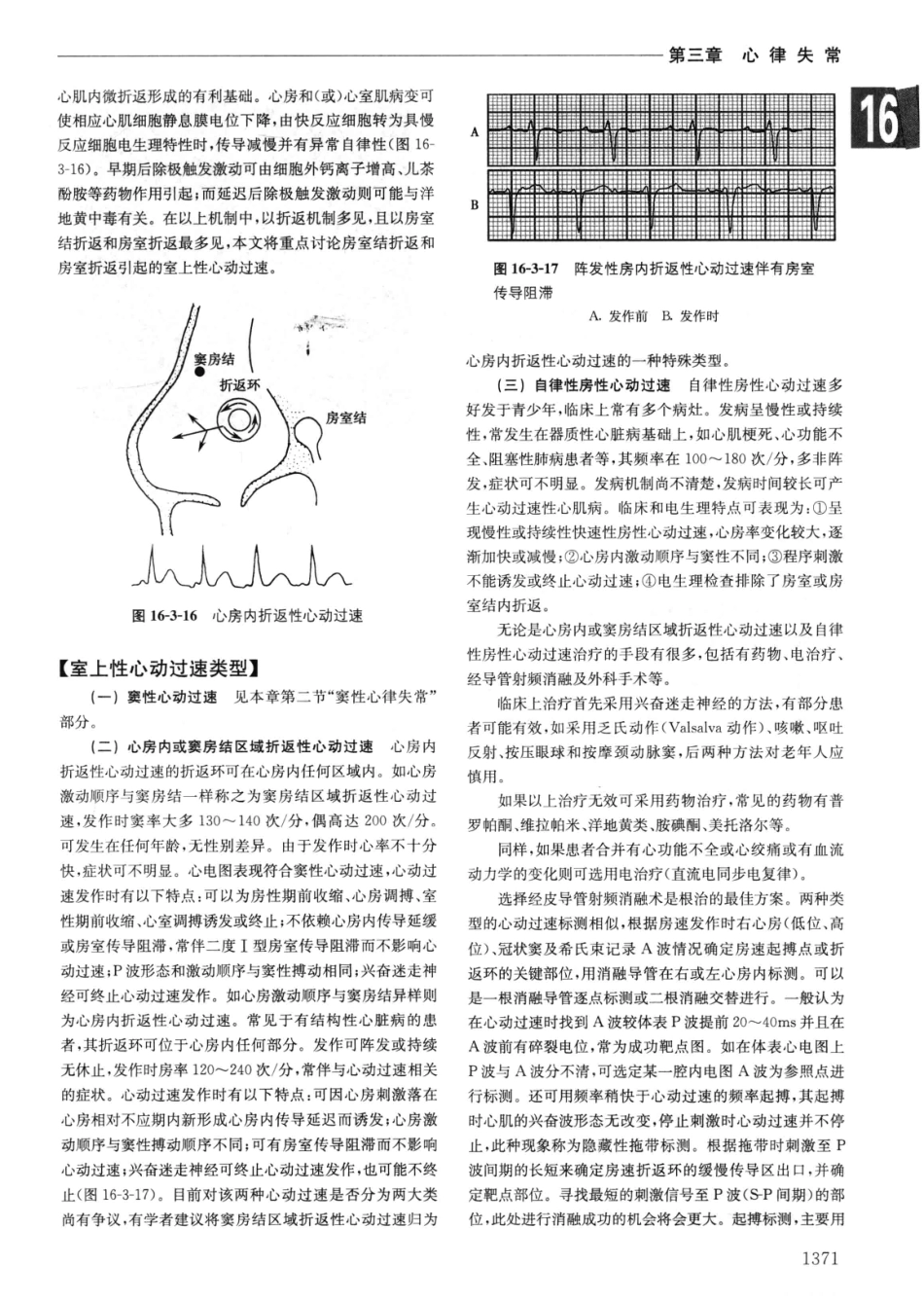 实用内科学++第14版++下_13442380_61-90.pdf_第3页