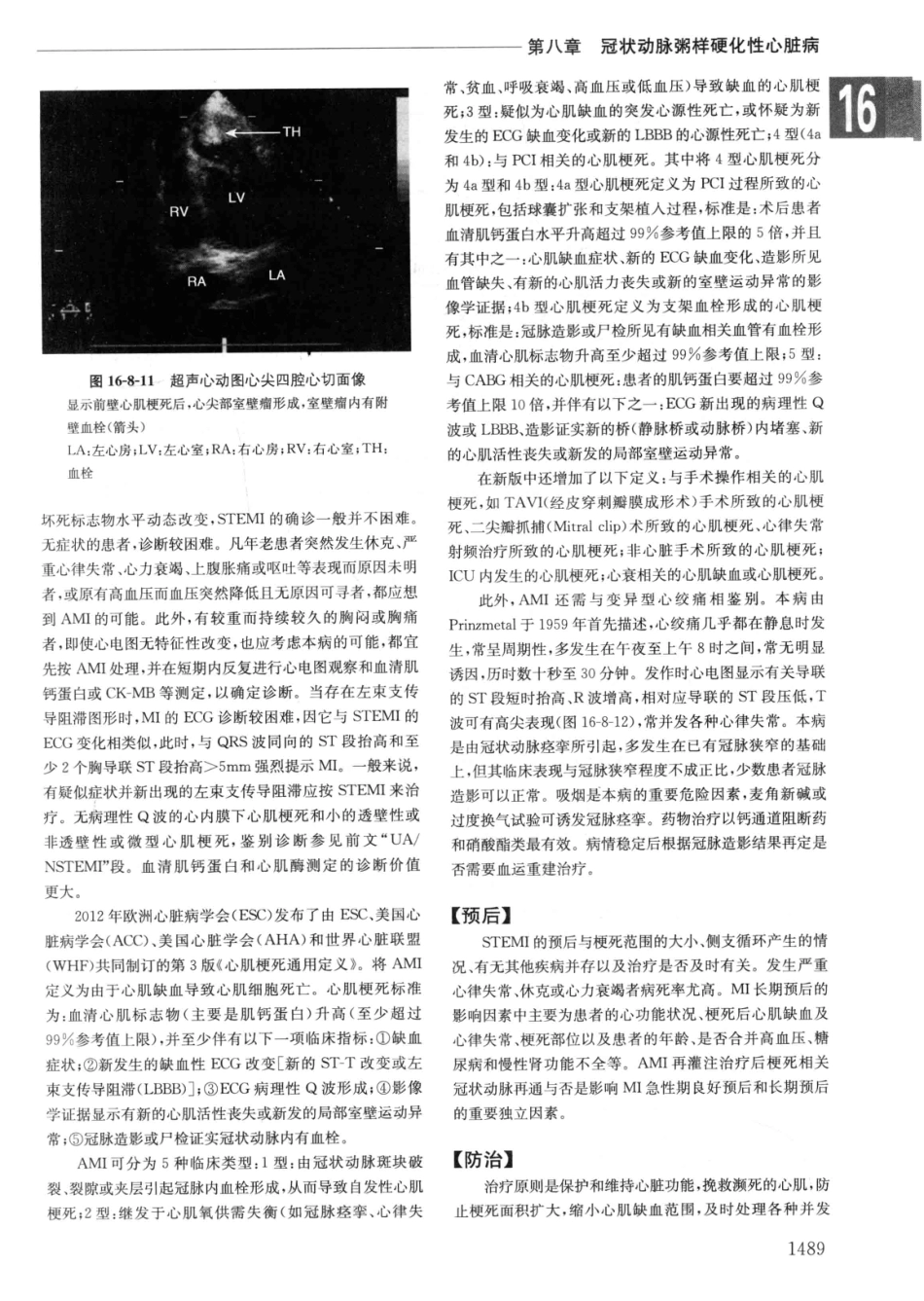 实用内科学++第14版++下_13442380_181-210.pdf_第1页