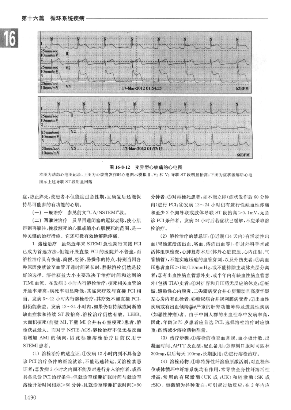实用内科学++第14版++下_13442380_181-210.pdf_第2页