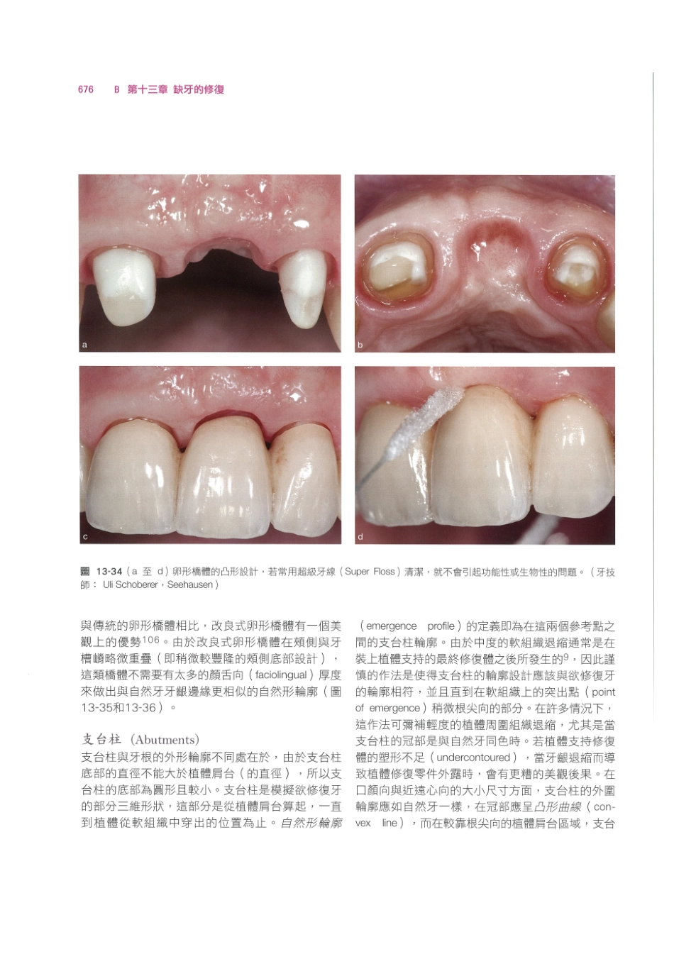 179.牙周整形美容与种植手术_689-696.pdf_第2页