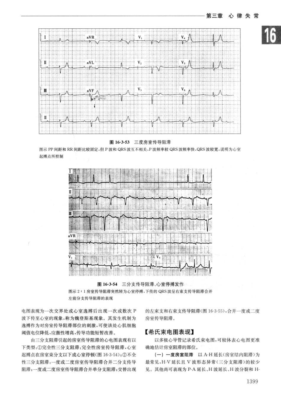 实用内科学++第14版++下_13442380_91-120.pdf_第1页