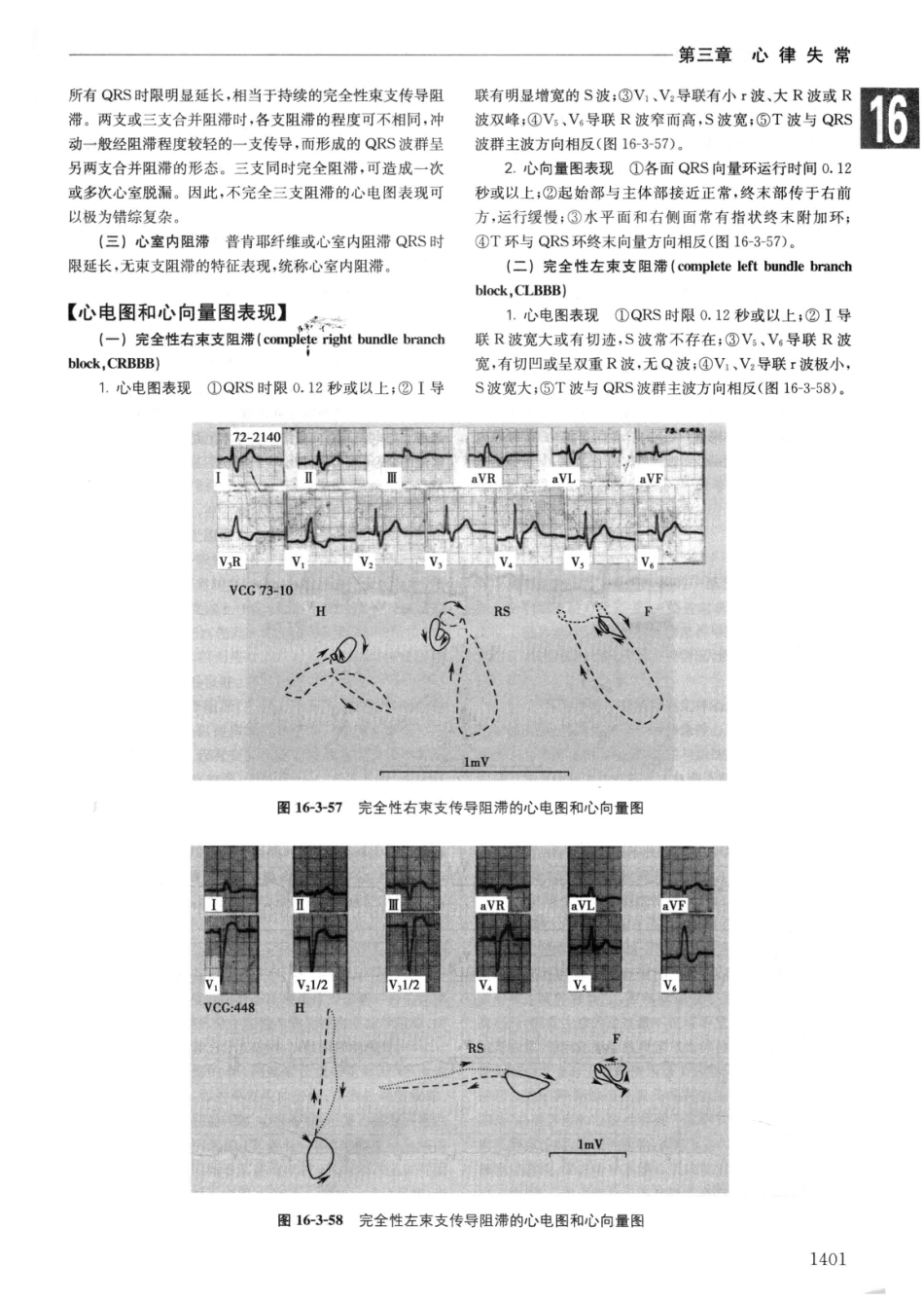 实用内科学++第14版++下_13442380_91-120.pdf_第3页