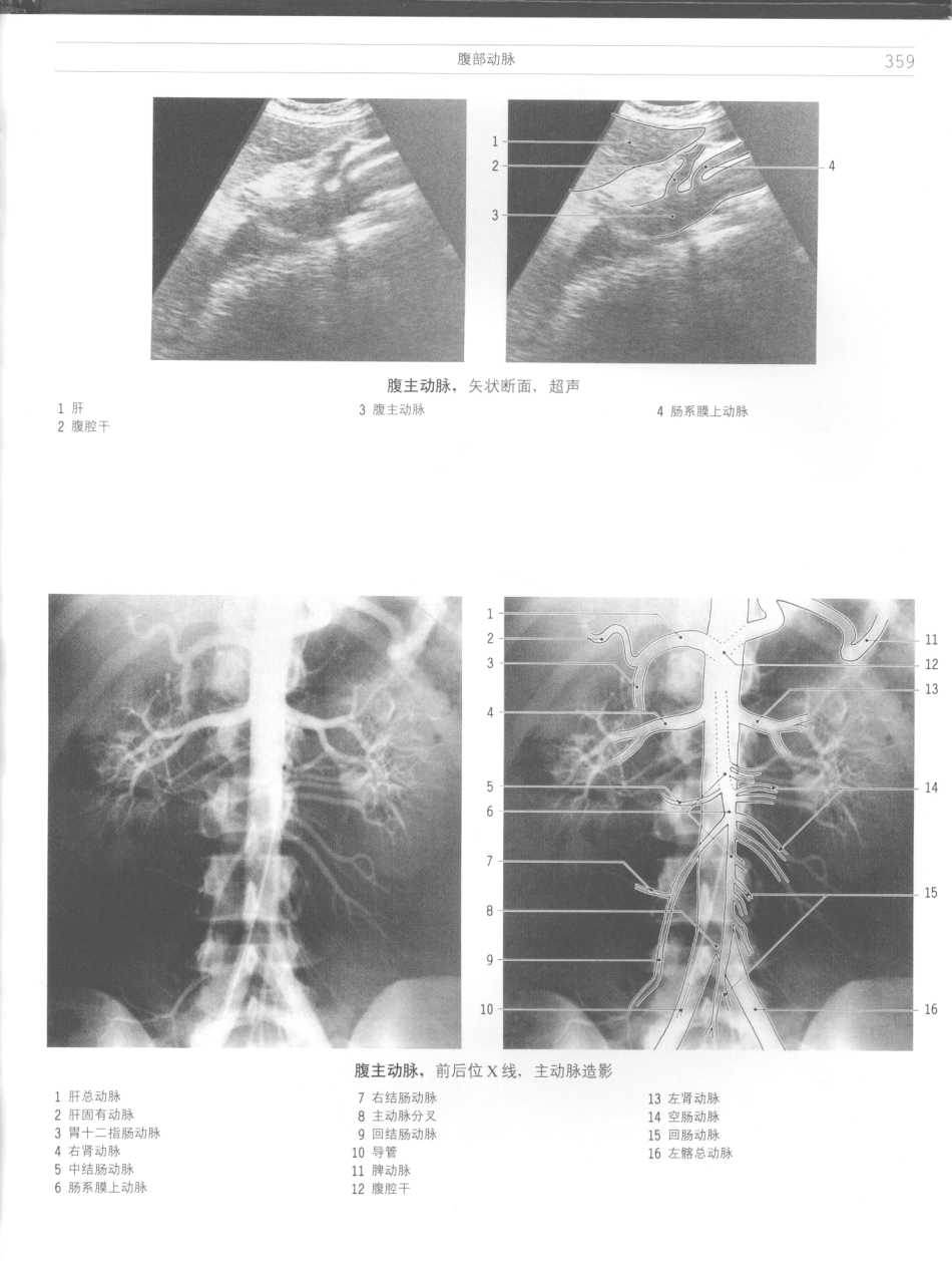 影像解剖学_11724881_361-372.pdf_第1页