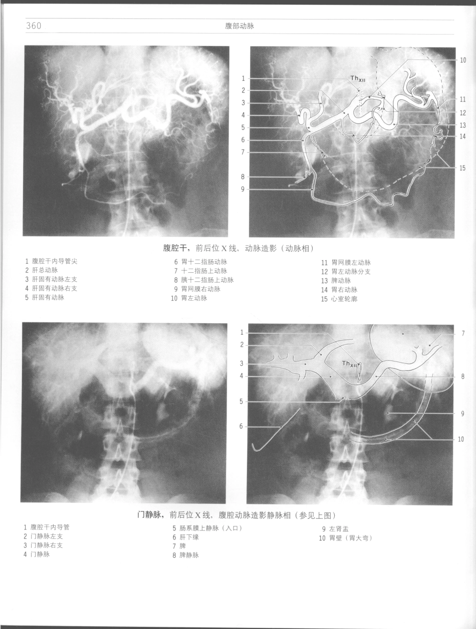 影像解剖学_11724881_361-372.pdf_第2页