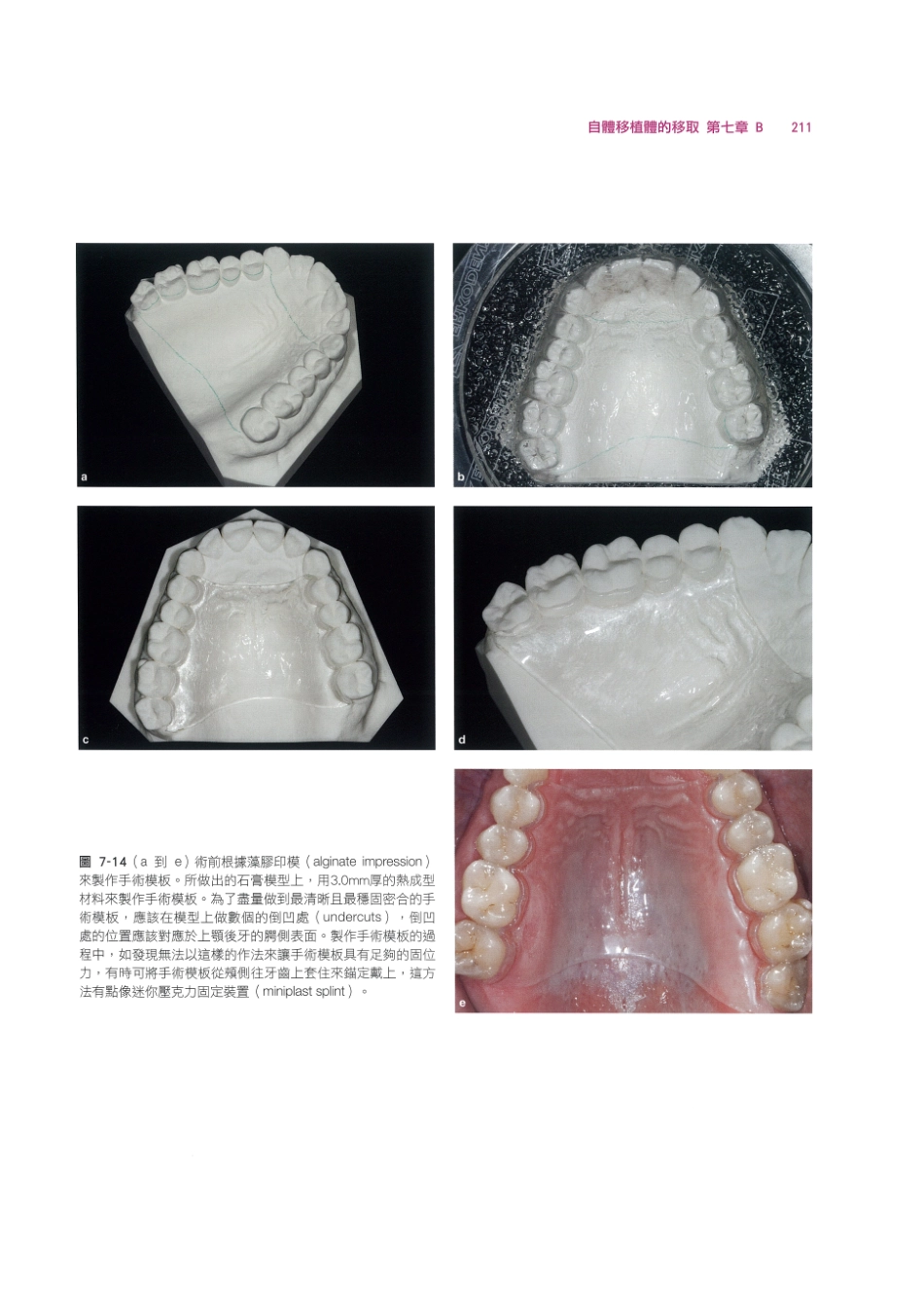179.牙周整形美容与种植手术_225-232.pdf_第1页