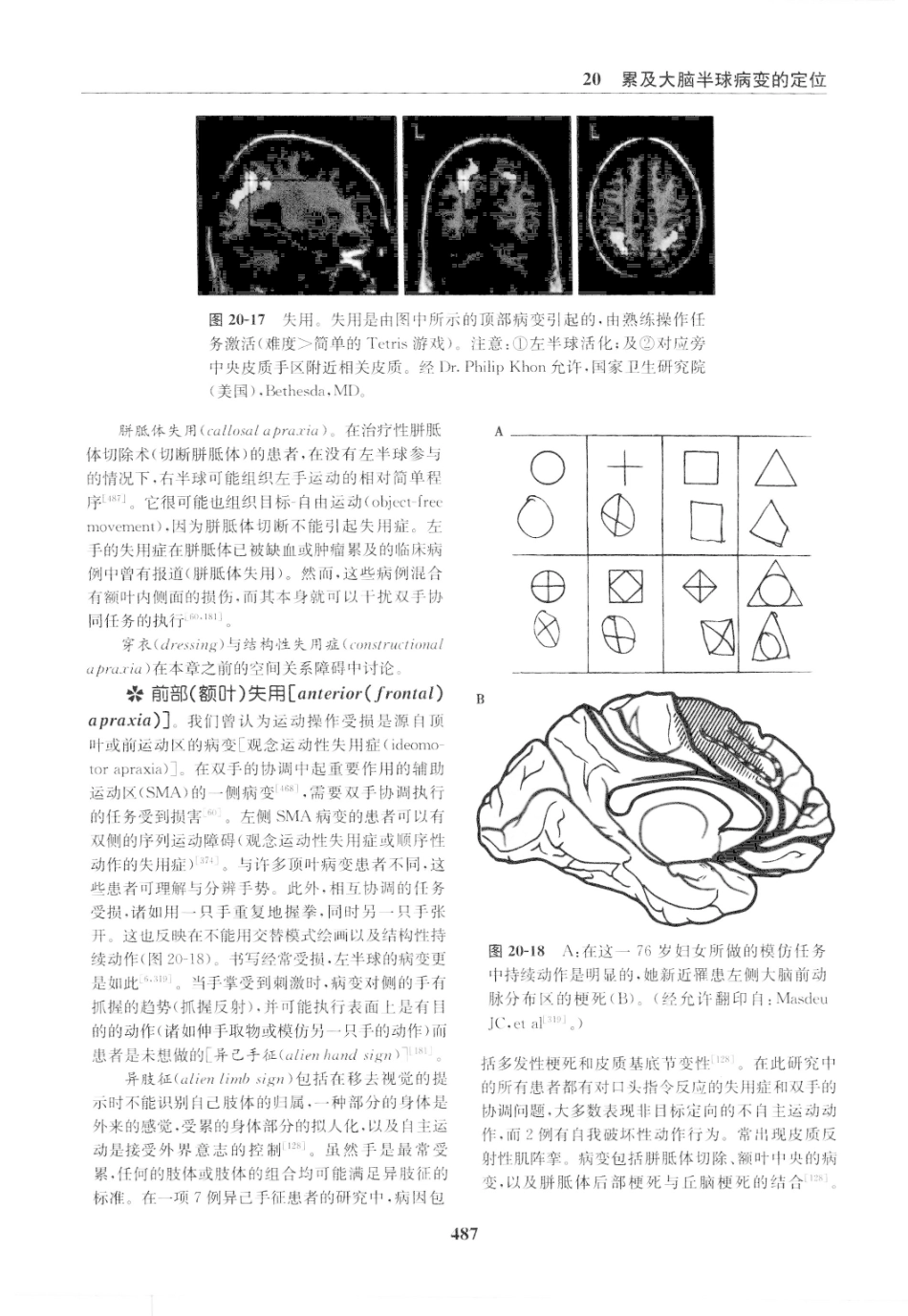 临床神经病学定位++第6版_13196861_496-510.pdf_第1页