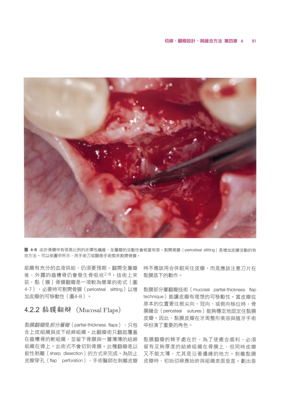 179.牙周整形美容与种植手术_105-112.pdf_第1页