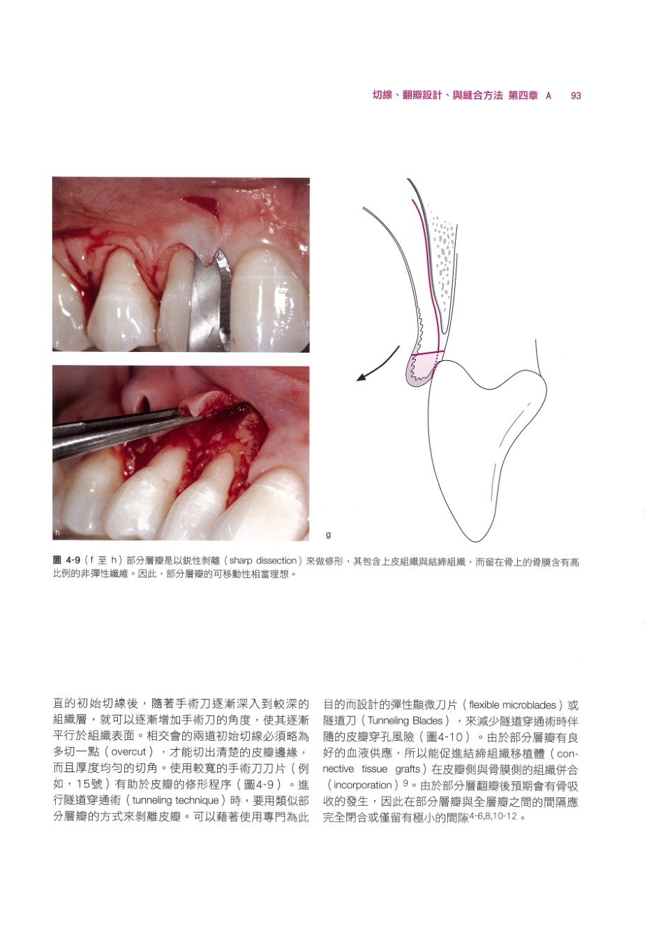 179.牙周整形美容与种植手术_105-112.pdf_第3页