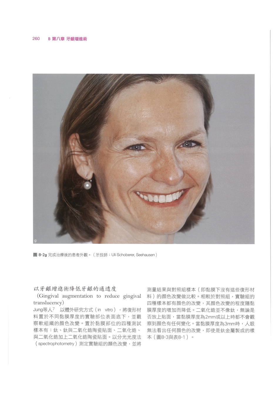 179.牙周整形美容与种植手术_273-280.pdf_第2页