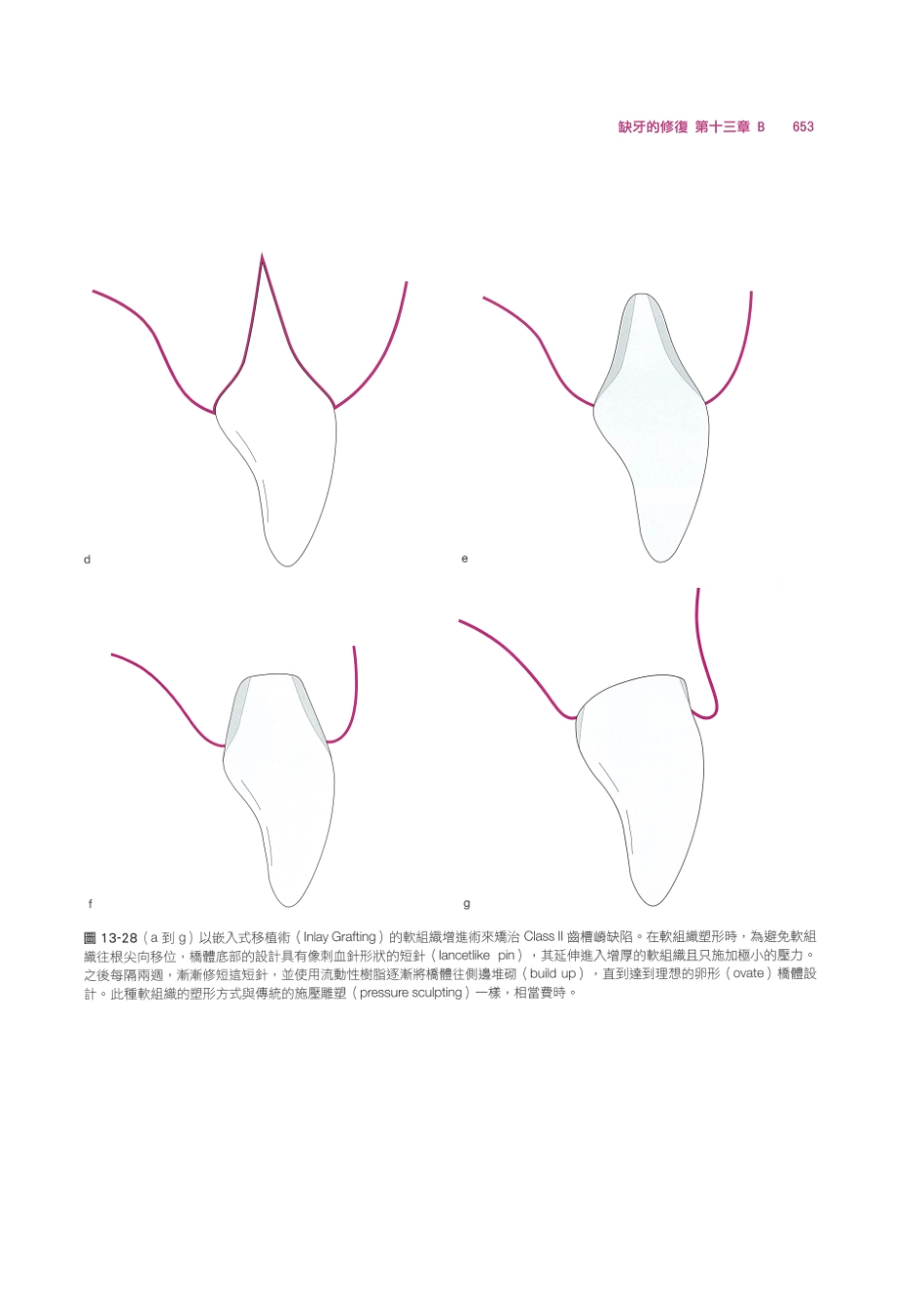 179.牙周整形美容与种植手术_665-672.pdf_第3页