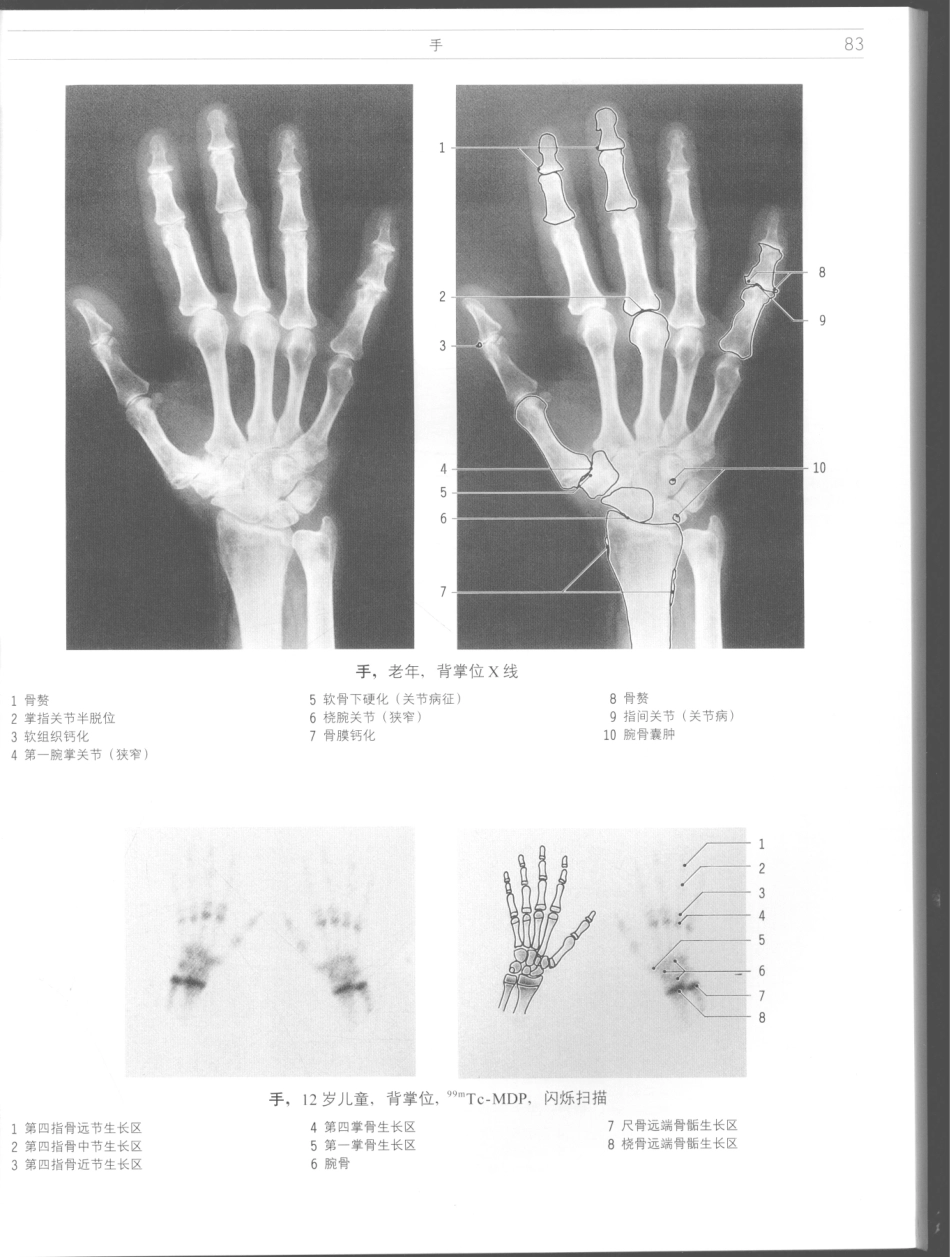 影像解剖学_11724881_85-96.pdf_第1页