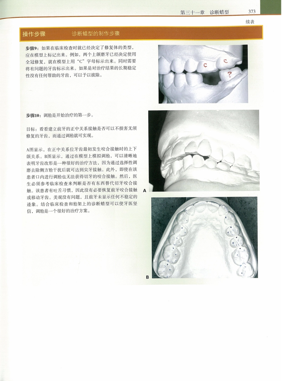 功能牙合学 从颞下颌关节到微笑设计2015年译(彩图)张豪_391-405.pdf_第1页