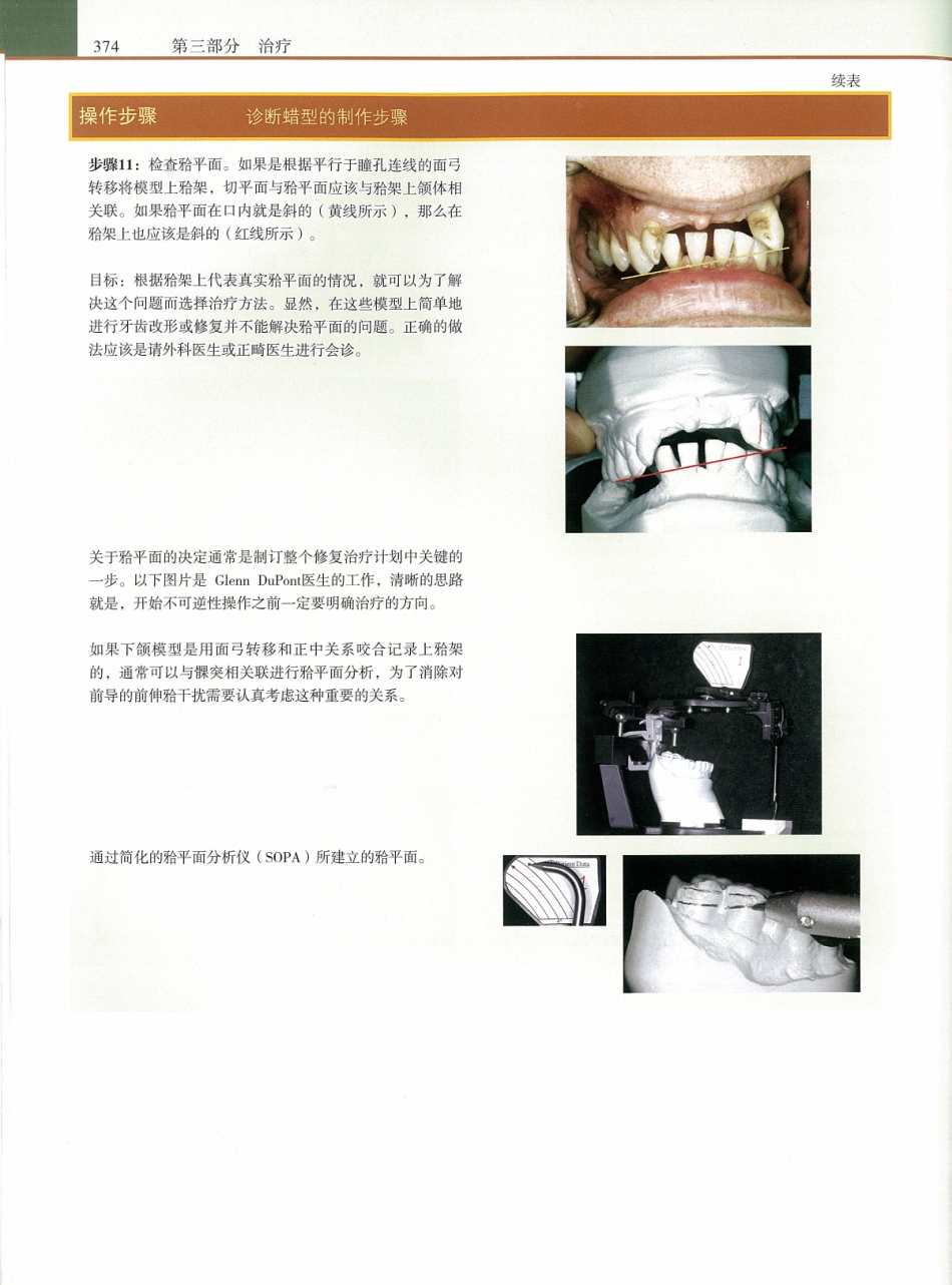 功能牙合学 从颞下颌关节到微笑设计2015年译(彩图)张豪_391-405.pdf_第2页